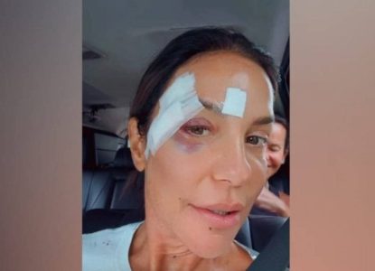 Após sofrer desmaio, Ivete Sangalo recebe alta e revela diagnóstico médico