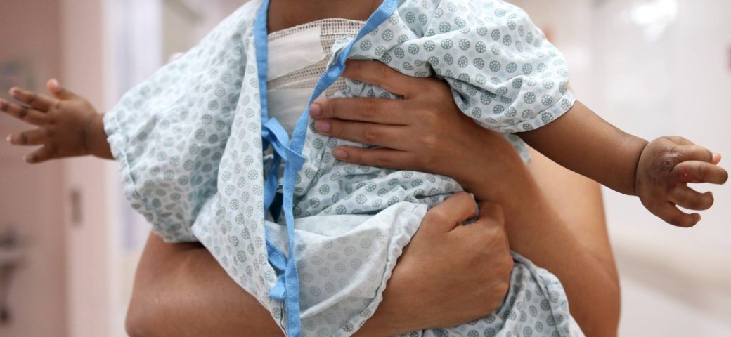 Rede estadual de saúde reforça hospitais para atender vítimas de queimaduras no São João