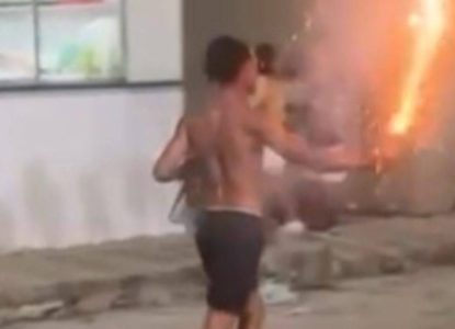Jovem perde dedo após explosão de espada durante festejos juninos em Cruz das Almas