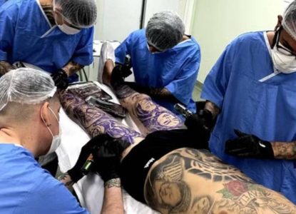 Conselho Federal de Medicina publica resolução que proíbe aplicar anestesia para fazer tatuagem