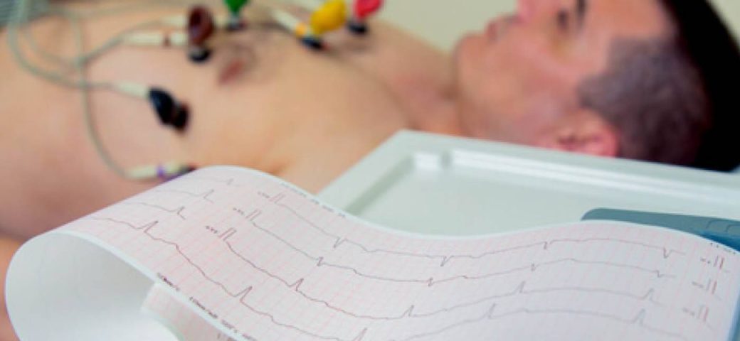 Casos de arritmia cardíaca disparam com envelhecimento da população