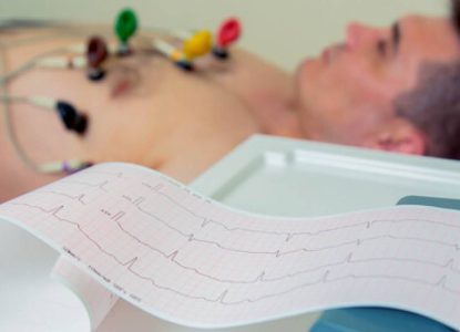 Casos de arritmia cardíaca disparam com envelhecimento da população