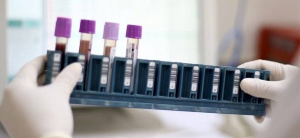 Bahia já tem pontos de coleta para exame genético de doenças raras pelo SUS