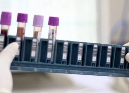 Bahia já tem pontos de coleta para exame genético de doenças raras pelo SUS