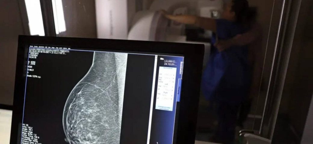 SUS vai oferecer teste genético para detectar risco de câncer de mama