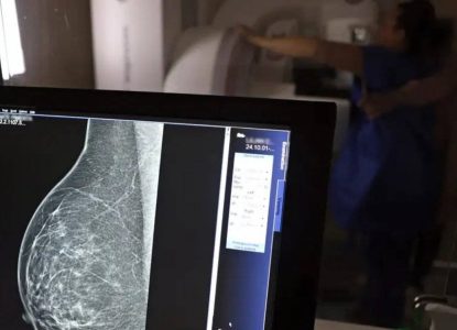 SUS vai oferecer teste genético para detectar risco de câncer de mama