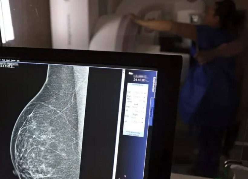 SUS vai oferecer teste genético para detectar risco de câncer de mama