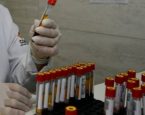 Alagoinhas: Vigilância amplia monitoramento de casos de arboviroses em parceria com laboratórios particulares