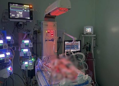 Bebê supera quadro gravíssimo e deixa UTI neonatal sem sequelas em Feira de Santana