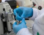 SUS vai oferecer novo tratamento para pacientes com leucemia mieloide aguda