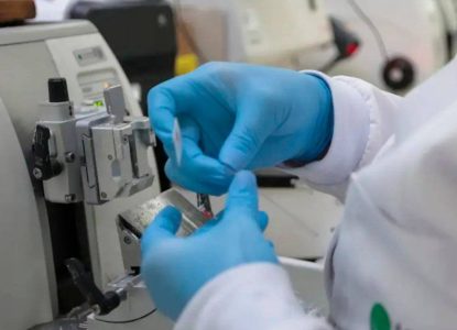 SUS vai oferecer novo tratamento para pacientes com leucemia mieloide aguda