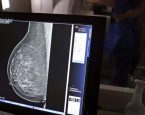 Carreta oferece mamografias gratuitas em Feira de Santana, Alagoinhas e Jequié; confira datas
