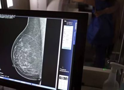 Carreta oferece mamografias gratuitas em Feira de Santana, Alagoinhas e Jequié; confira datas