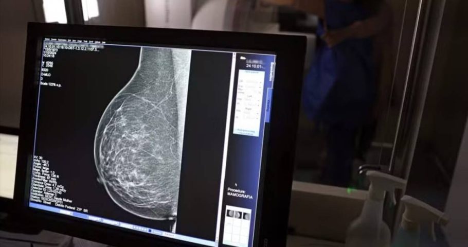 Carreta oferece mamografias gratuitas em Feira de Santana, Alagoinhas e Jequié; confira datas