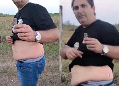 Candidato ao governo da Bahia, Aroldo Félix é atingido por bala de borracha durante manifestação em Salvador